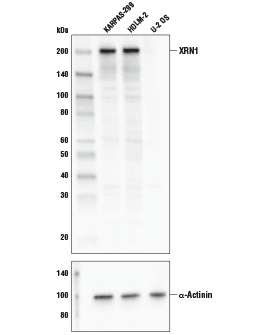 XRN1 Antibody #70205